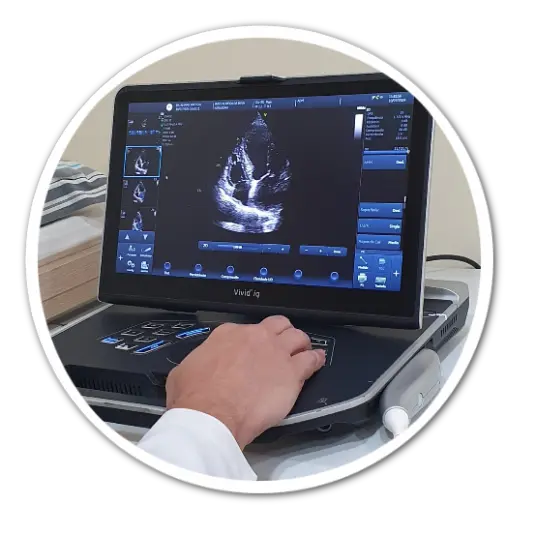Ecodoppler de Carotidas e Vertebrais Ecodoppler de Carotidas e Vertebrais