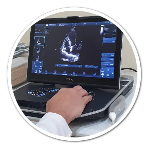 eletrocardiograma eletrocardiograma